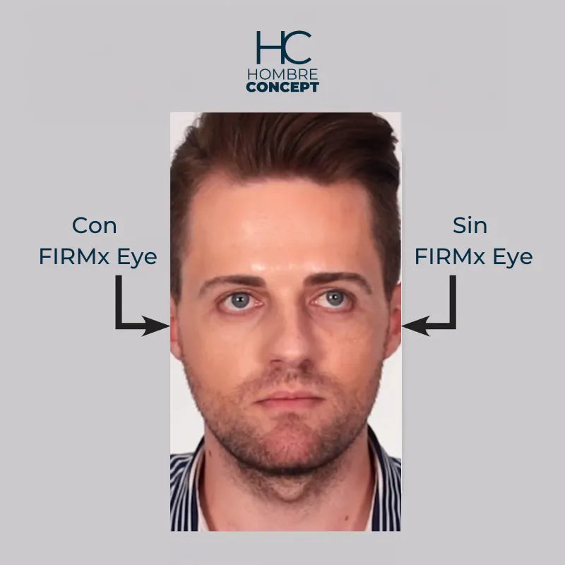 Instant FIRMx – Rajeunissez en 90 Secondes