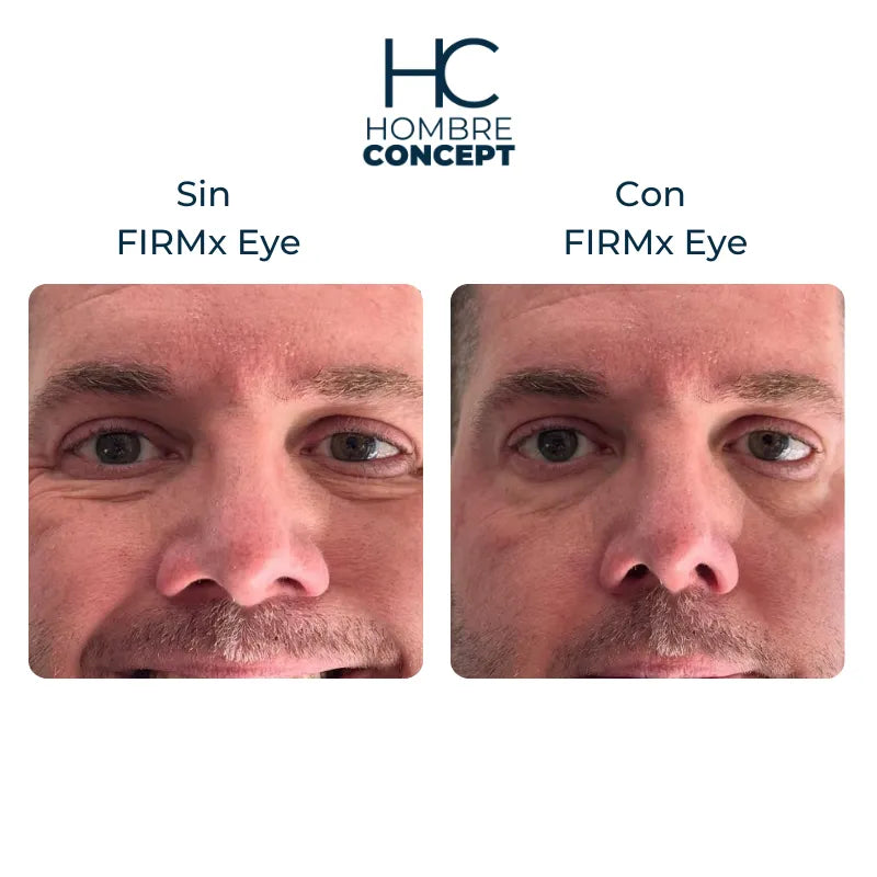 Instant FIRMx – Rajeunissez en 90 Secondes