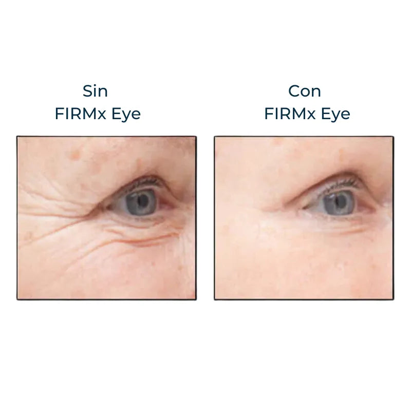 Instant FIRMx – Rajeunissez en 90 Secondes