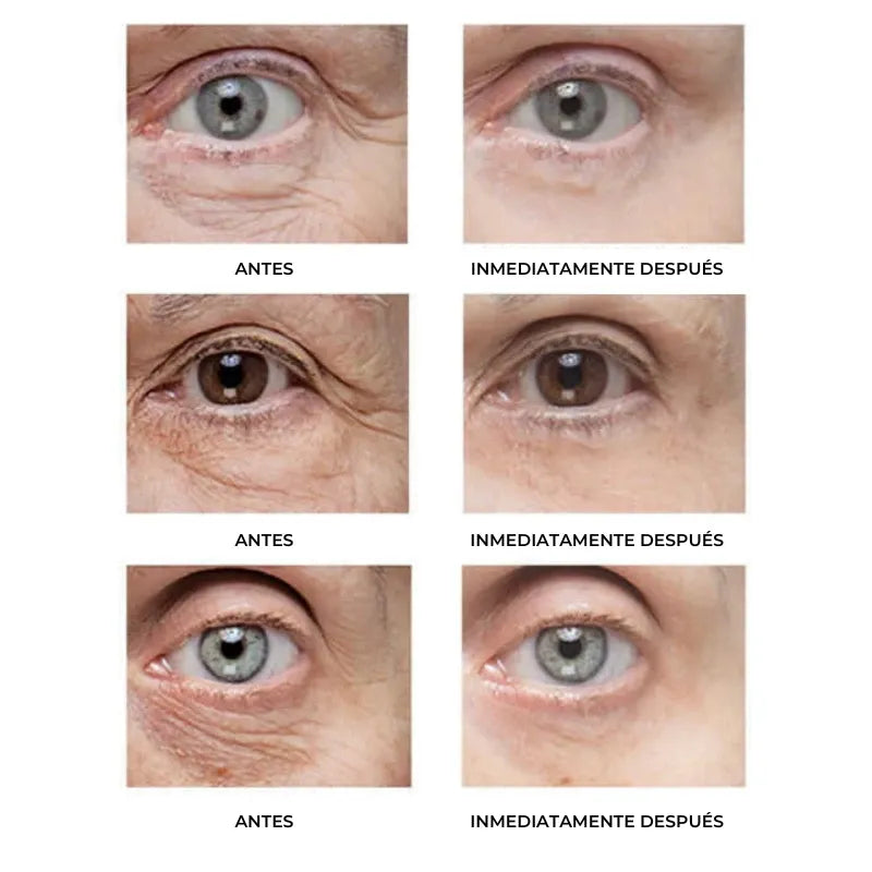 Instant FIRMx – Rajeunissez en 90 Secondes